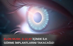 Elon Musk Duyurdu: Neuralink Görme İmplantı İçin 6-12 Aylık Takvim